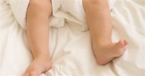 White Bumps On My Infants Legs Livestrongcom