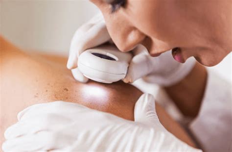 Best dermatologist in kochi kerala skin,dermatology,dermatologist,skin dermatology hair & skin treatment, general dermatology and cosmetic dermatology.skin problems doctor acne skin issues dermatologist in kochi , ernakulam. What to Look for in the Best Dermatologist | Chicago ...