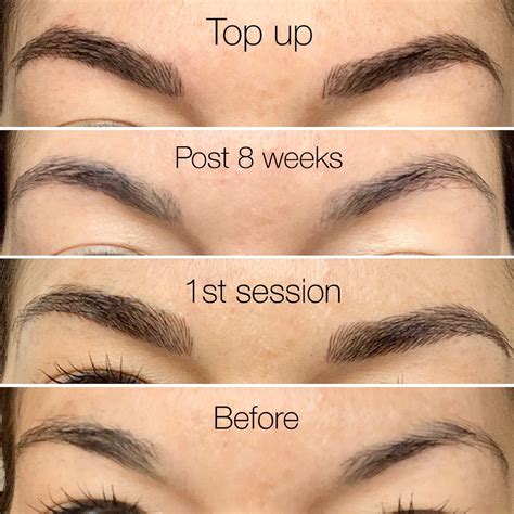 Here Are The Stages Of My Own Microbladed Eyebrows Not My Work As