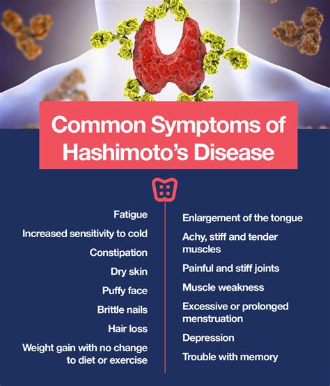 Symptoms Of Hashimotos Disease