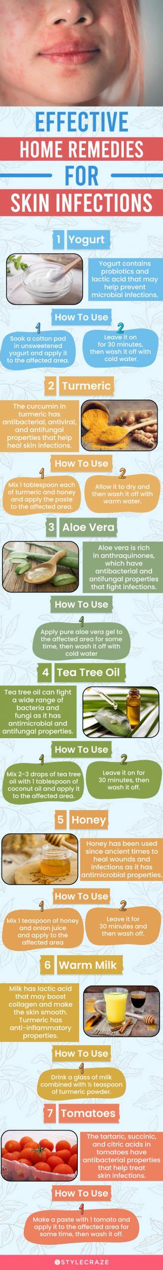 23 Effective Home Remedies For Skin Infection