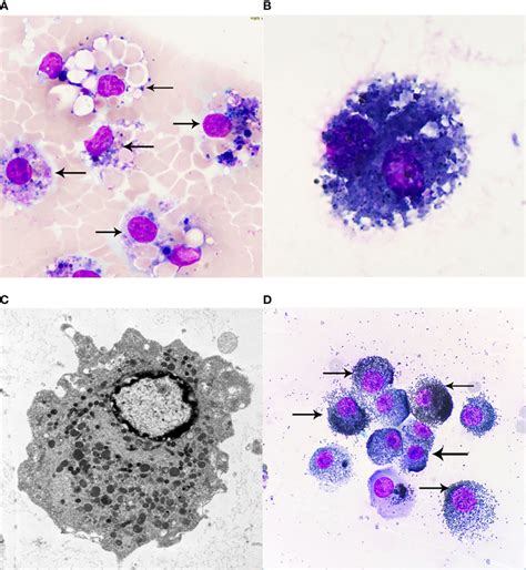 A Hemosiderin Cells Wright Giemsa Stained ×1000 Macrophages Engulf