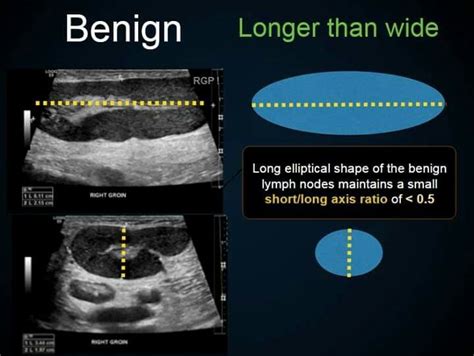 Pin By Kat Straight On Medical With Images Ultrasound Diagnostic