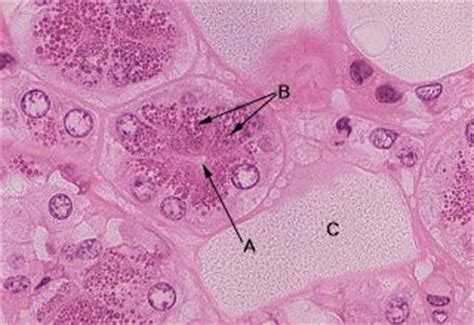 Oral Histology Digital Lab Glands Serous Secretory Cells Image 6