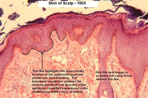 P Scalp 100x 3 Epidermal Basement Membrane