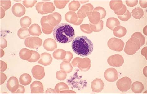 Veterinary Hematology Dextervet Monocyte With A Band Neuthrophil At