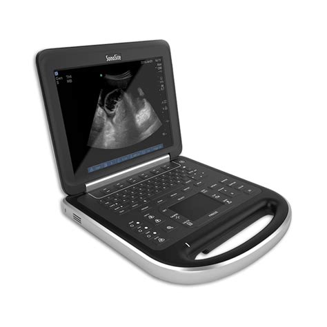 Philips Cx50 Portable Ultrasound System Avante Health Solutions