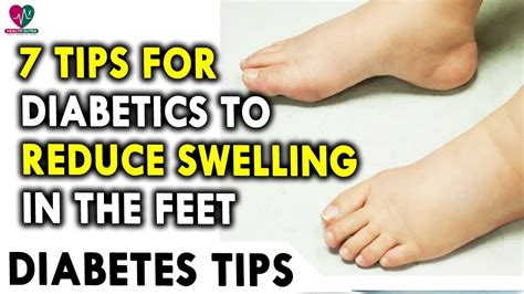 7 Tips For Diabetics To Reduce Swelling In The Feet Diabetic Tips For