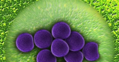 Klasifikasi Dan Morfologi Bakteri Staphylococcus Aureus Kumpulan