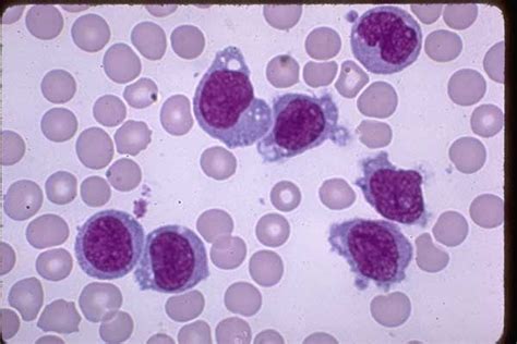 Monocytes Are Cd11b And Cd15 Early Then Gain Cd64 And Cd14 Histology