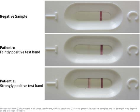 Figure 2 From Application In Europe Of A Urine Based Rapid Diagnostic