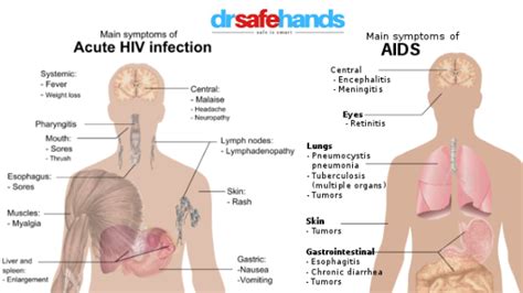 know hiv aids facts symptoms and treatments