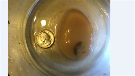 Parents Release Photos Of Baby Miscarried At 5 Weeks To Show Humanity