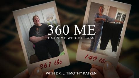 360 Body Lift After Extreme Weight Loss Mary 360 Me Youtube