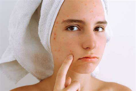 Age Spot Remover The Best Way To Get Rid Of Age Spots