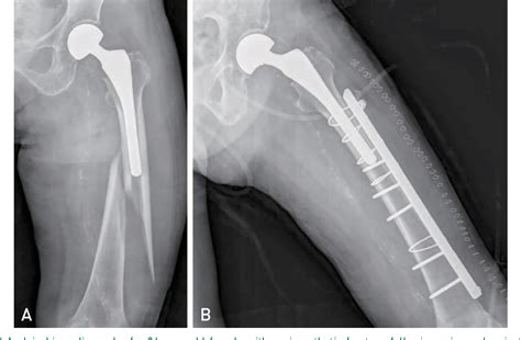 Figure 4 From Could Patient Undergwent Surgical Treatment For