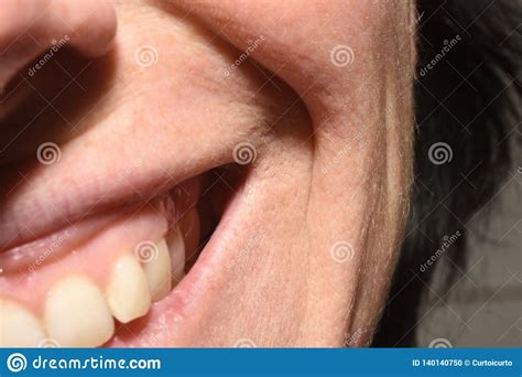 Wrinkles On The Lips From The Smile Of A 43 Year Old Woman Stock Photo
