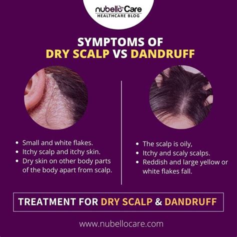 10 Dandruff Flakes Vs Dry Scalp Flakes Fashionblog