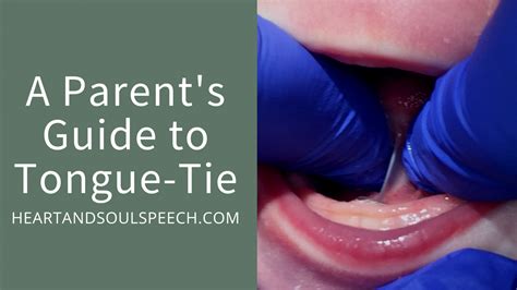 A Parent S Guide To Tongue Tie Heart Soul Speech
