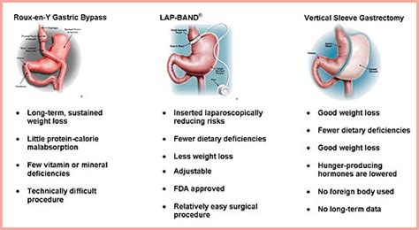 Obesity Related Diseases And Conditions Seeking Medical