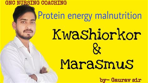 Protein Energy Malnutrition Kwashiorkor And Marasmus Youtube