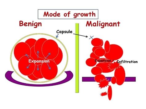 Benign And Malignant Tumor Comparison