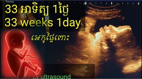 អេកូផ្ទៃពោះ 33អាទិត្យ 1ថ្ងៃ Pregnancy Ultrasound 33 Weeks 1 Day By Dr