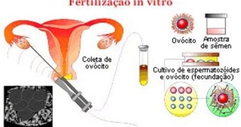 Jessica marie roberdo tarafından başarıldı. Arlene Castro