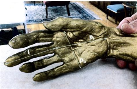 Paganinis Hands Were Abnormal Lingling40hrs
