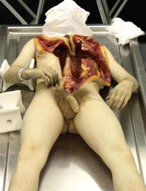 Autopsy Picture Hot Sex Picture