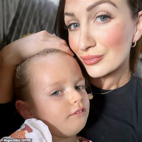 Mothers Agony As Three Year Old Daughters Squint Turns Out To Be A