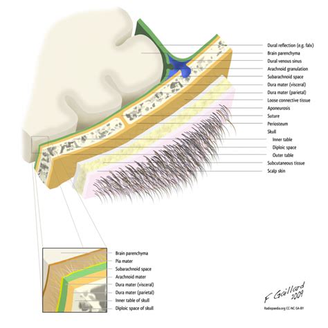 Occipital Bone Explained In Xr Anatomy 101 For Patients