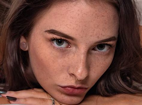 we love freckles photo contest winners