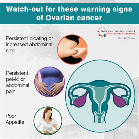 Ovarian Cancer Symptoms Pin On Ovarian Cancer Symptoms Ovarian Cancer May Not Cause Any