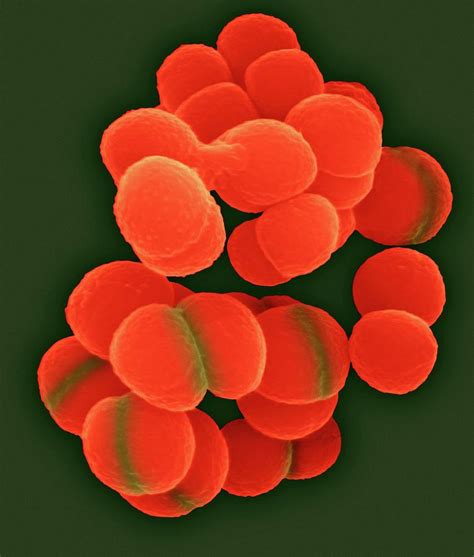 Deinococcus Radiophilus Photograph By Dennis Kunkel Microscopyscience