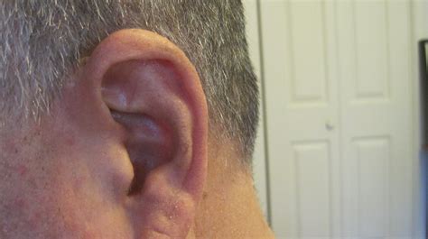 Free Stock Photo Of Door Ear Earache