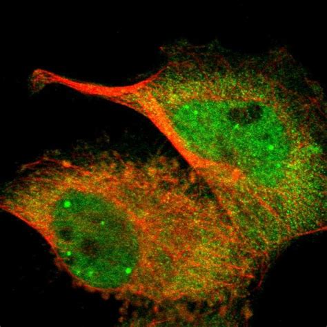 Anogenital space is used to differentiate newborns' sex. 抗WWTR1抗体 (Anti-WWTR1 Antibody) | ヒト組織免疫染色用抗体 | フナコシ