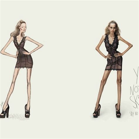 Modeling Agency Makes Creepy Anti Anorexia Ads