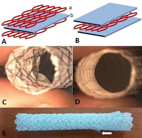 Modification Of Metallic Stent Incorporating Paclitaxel Impregnated