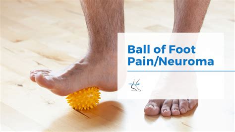 Foot Neuroma Treatment Pain Relief Moore Foot And Ankle Specialists