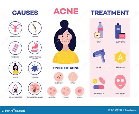 Poster Showing The Causes And Methods Of Treating Acne Flat Vector