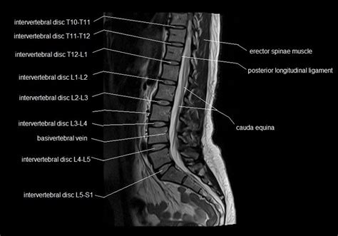 Microscopic anatomy of skeletal muscle. MRI spine anatomy | free MRI lumbar spine sagittal cross sectional anatomy in 2020 | Mri ...