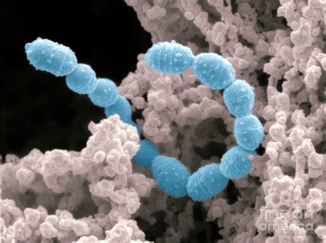 Lactococcus Lactis Bacteria In Yogurt Photograph By Scimat