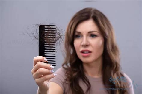 اصلی ترین دلیل ریزش مو شدید در زنان به نظر متخصصان پوست