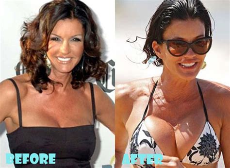 Janice Dickinson Plastic Surgery Before And After Lovely Surgery Celebrity Before And After