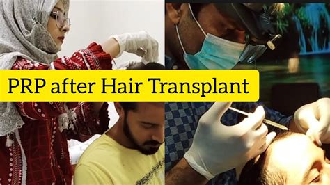 Prp After Hair Transplant Prp Complete Process Youtube