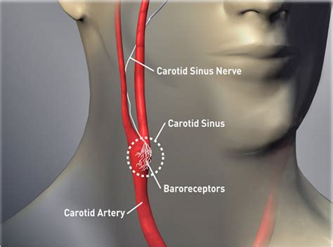 Carotid Artery In The Neck And Why You Shouldnt Coil Or Twist This Part
