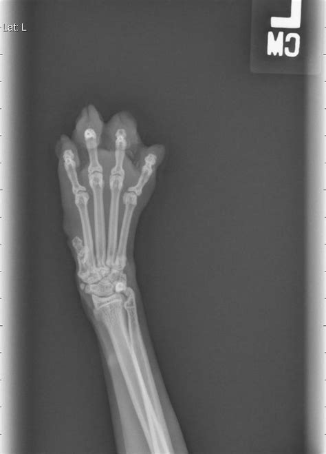 Rradiology Posted By Ukyla420 3 Years Ago X Ray