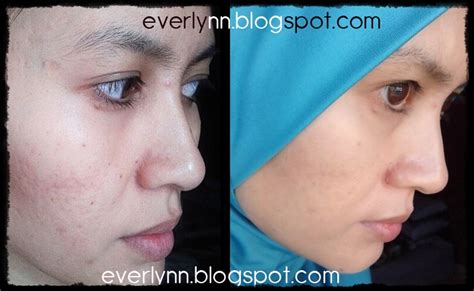 Telefono, indirizzo, vendite, impiegati, società equilibrio, ultime notizie su liu liang e molto di più. Everlynn Beauty & Healthy: Testimoni - Customer Everlynn