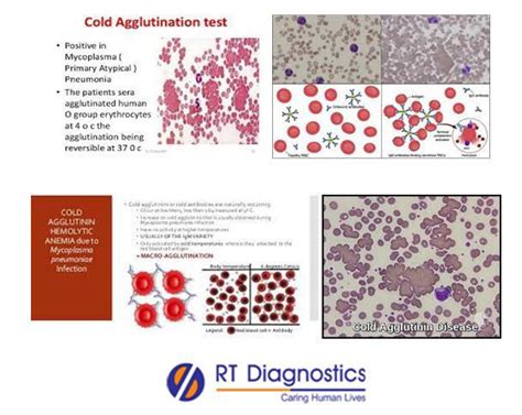 Cold Agglutination Rt Diagnostics